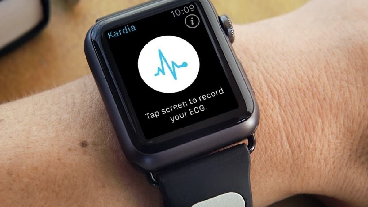 The evolution of the smartwatch